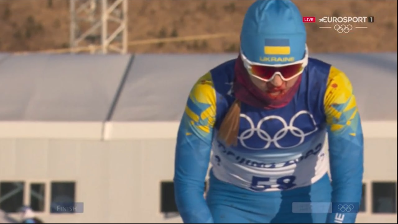 Украинская лыжница финишировала на Олимпиаде с окровавленным лицом